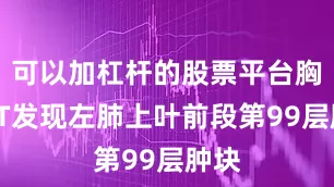 可以加杠杆的股票平台胸部CT发现左肺上叶前段第99层肿块